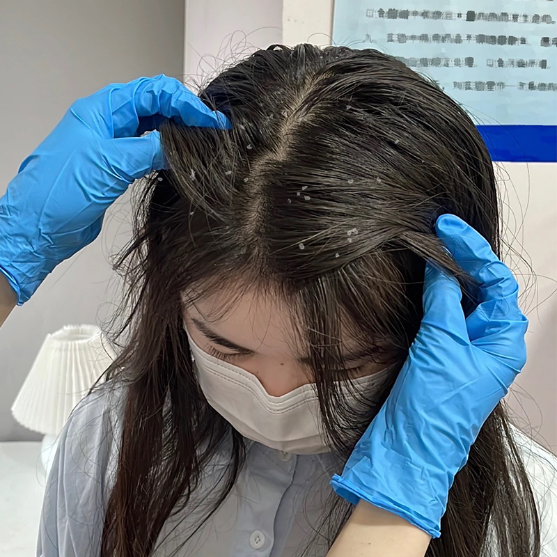 醋洗头发有什么好处