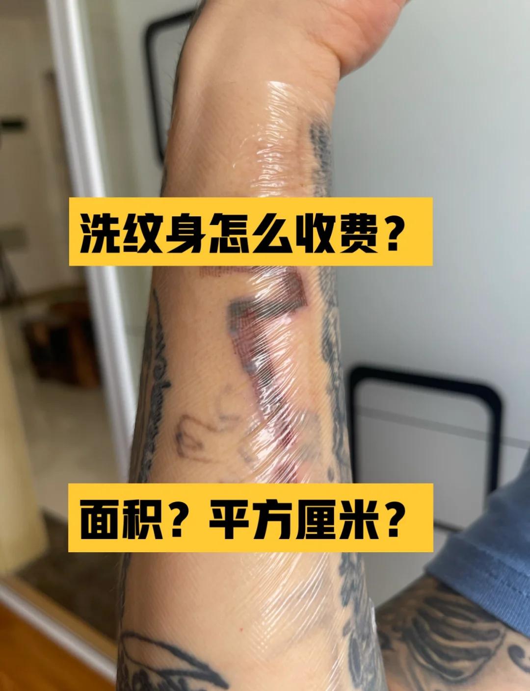 洗纹身一般多少钱